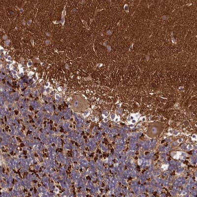 Immunohistochemistry-Paraffin: DMXL2 Antibody [NBP1-93618]