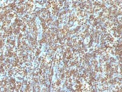 Immunohistochemistry-Paraffin: DNA Antibody (121-3) - Azide and BSA Free [NBP2-78054]