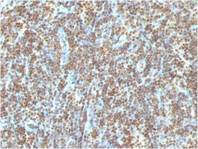 Immunohistochemistry-Paraffin: DNA Antibody (121-3) - IHC-Prediluted [NBP2-48325]