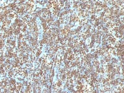 Immunohistochemistry-Paraffin: DNA Antibody (121-3) [NBP2-45197]