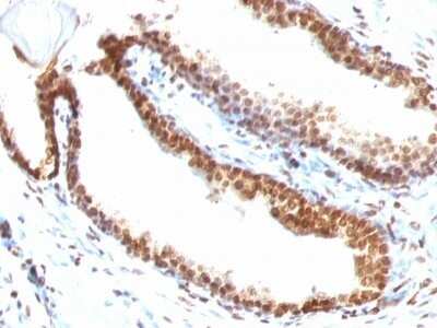 Immunohistochemistry-Paraffin: DNA Antibody (DSD/958) - IHC-Prediluted [NBP2-48142]