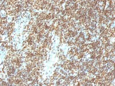 Immunohistochemistry-Paraffin: DNA Antibody (DSD/958) - IHC-Prediluted [NBP2-48142]