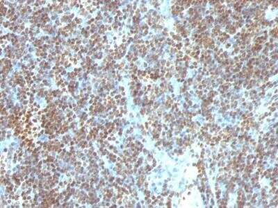 Immunohistochemistry-Paraffin: DNA Antibody (SPM603) - IHC-Prediluted [NBP2-48326]