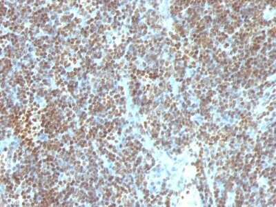 Immunohistochemistry-Paraffin: DNA Antibody (SPM603) [NBP2-45205]