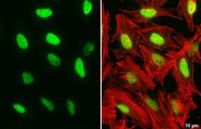Immunocytochemistry/ Immunofluorescence: DNA Ligase I Antibody (10H5) [NB100-119]
