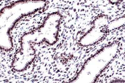Immunohistochemistry-Paraffin: DNA Ligase I Antibody (10H5) [NB100-119]