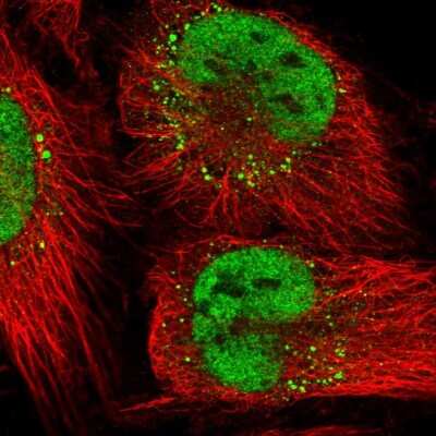 Immunocytochemistry/ Immunofluorescence: DNA Ligase I Antibody [NBP2-55992]