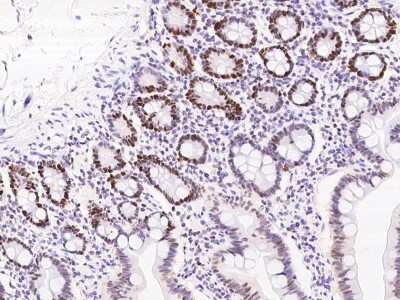 Immunohistochemistry-Paraffin: DNA Ligase I Antibody [NBP2-97831]