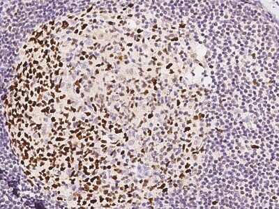 Immunohistochemistry-Paraffin: DNA Ligase I Antibody [NBP2-97831]