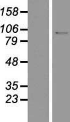 Western Blot: DNA Ligase I Overexpression Lysate [NBP2-11159]