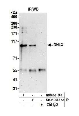 Immunoprecipitation: DNA Ligase III Antibody [NB100-81661]