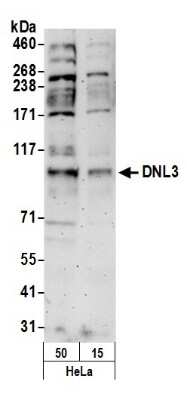 Western Blot: DNA Ligase III Antibody [NB100-81661]