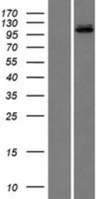 Western Blot: DNA Ligase III Overexpression Lysate [NBL1-12520]