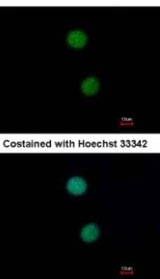 Immunocytochemistry/ Immunofluorescence: DNA Ligase IV Antibody [NBP2-16182]