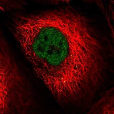 Immunocytochemistry/ Immunofluorescence: DNA Ligase IV Antibody [NBP2-68729]