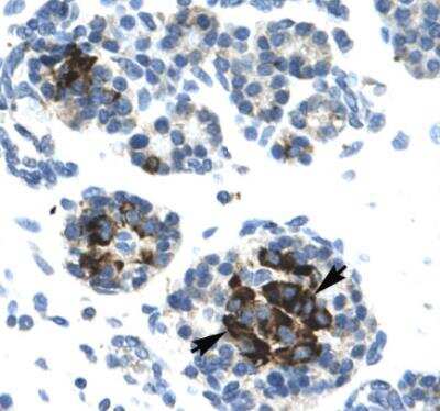 Immunohistochemistry: DNA Ligase IV Antibody [NB110-57379]