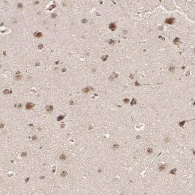Immunohistochemistry-Paraffin: DNA Ligase IV Antibody [NBP1-87405]
