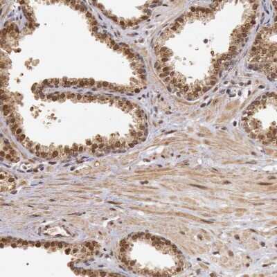 Immunohistochemistry-Paraffin: DNA Ligase IV Antibody [NBP1-87405]