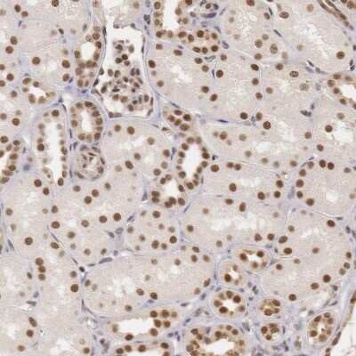 Immunohistochemistry-Paraffin: DNA Ligase IV Antibody [NBP1-87405]