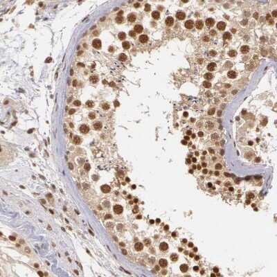 Immunohistochemistry-Paraffin: DNA Ligase IV Antibody [NBP1-87405]