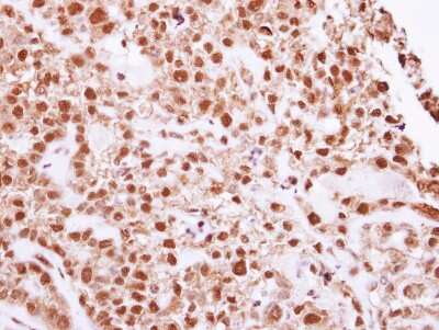 Immunohistochemistry-Paraffin: DNA Ligase IV Antibody [NBP2-16182]