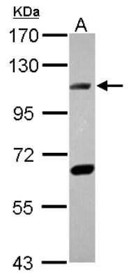 Western Blot: DNA Ligase IV Antibody [NBP2-16182]