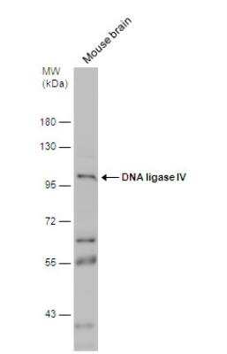 Western Blot: DNA Ligase IV Antibody [NBP2-16182]