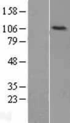 Western Blot: DNA Ligase IV Overexpression Lysate [NBL1-12522]