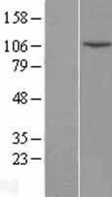 Western Blot: DNA Ligase IV Overexpression Lysate [NBP2-11429]