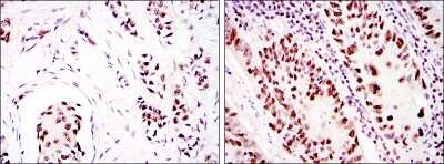 Immunohistochemistry-Paraffin: DNA-PKcs Antibody (3H6) - BSA Free [NBP2-22128]