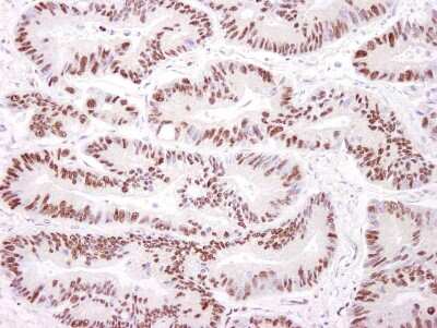 Immunohistochemistry-Paraffin: DNA-PKcs Antibody [NB100-659]