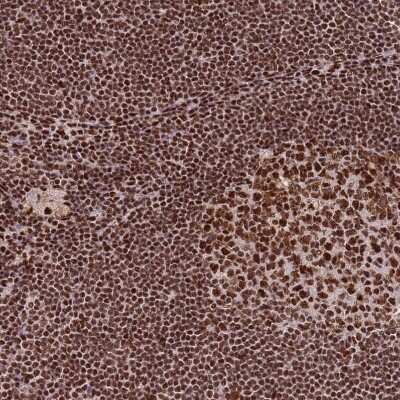Immunohistochemistry-Paraffin: DNA-PKcs Antibody [NBP2-33995]