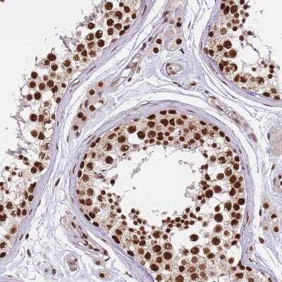 Immunohistochemistry-Paraffin: DNA-PKcs Antibody [NBP2-33995]