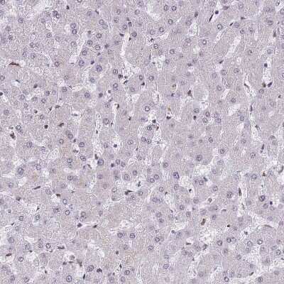 Immunohistochemistry-Paraffin: DNA-PKcs Antibody [NBP2-33995]