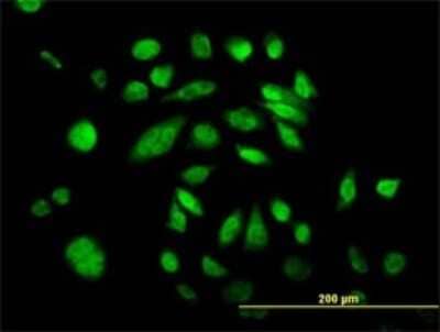 Immunocytochemistry/ Immunofluorescence: DNA Polymerase Kappa Antibody (6F2) [H00051426-M01]