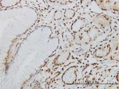 Immunohistochemistry-Paraffin: DNA Polymerase Kappa Antibody (6F2) [H00051426-M01]