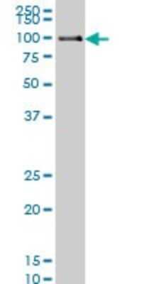 Western Blot: DNA Polymerase Kappa Antibody (6F2) [H00051426-M01]