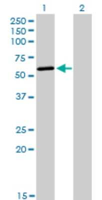 Western Blot: DNA Polymerase Kappa Antibody (6F2) [H00051426-M01]
