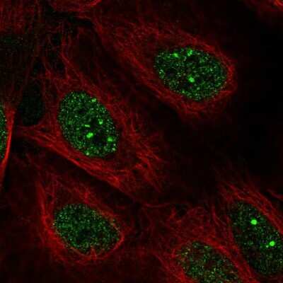 Immunocytochemistry/ Immunofluorescence: DNA Polymerase Kappa Antibody [NBP2-56673]