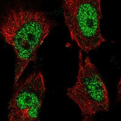 Immunocytochemistry/ Immunofluorescence: DNA Polymerase Kappa Antibody [NBP2-57385]