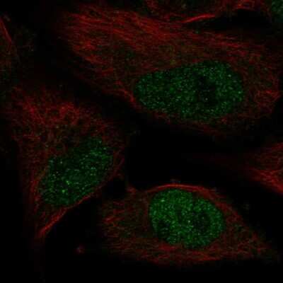 Immunocytochemistry/ Immunofluorescence: DNA Polymerase Kappa Antibody [NBP2-57541]