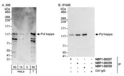 Western Blot: DNA Polymerase Kappa Antibody [NBP1-06559]