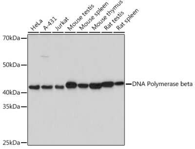 Western Blot: DNA Polymerase beta Antibody (6M8I5) [NBP3-16127]