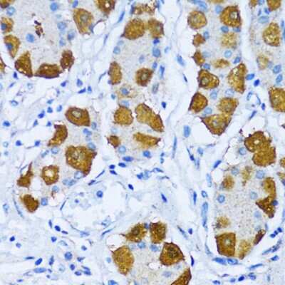 Immunohistochemistry-Paraffin: DNA Polymerase beta Antibody - BSA Free [NBP3-03454]