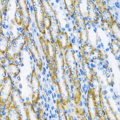 Immunohistochemistry-Paraffin: DNA Polymerase beta Antibody - BSA Free [NBP3-03454]