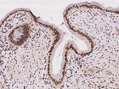 Immunohistochemistry-Paraffin: DNA Polymerase beta Antibody [NBP3-05939]