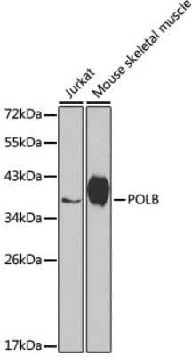 Western Blot: DNA Polymerase beta AntibodyBSA Free [NBP3-03454]