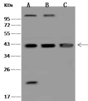 Western Blot: DNA Polymerase beta Antibody [NBP3-05939]