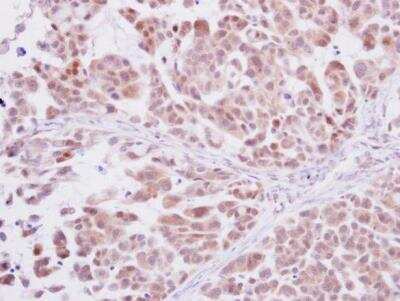 Immunohistochemistry-Paraffin: DNA Polymerase delta, catalytic subunit Antibody [NBP1-31541]