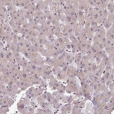 Immunohistochemistry-Paraffin: DNA Polymerase delta, catalytic subunit Antibody [NBP2-33466]